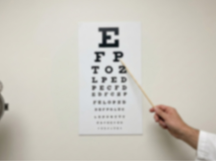 Wykres przed użyciem – stan fotoreceptorów